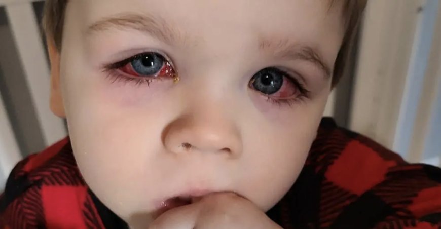 Moeder deelt waarschuwing over ‘onschuldig’ speelgoed dat bijna tot blindheid van haar kind leidde